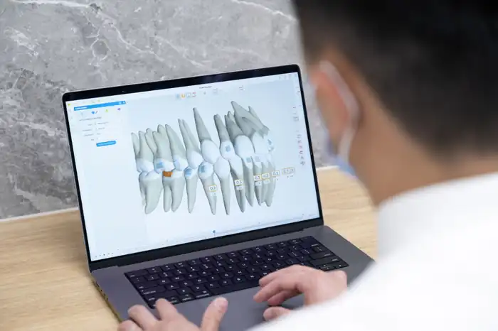 Digital orthodontic treatment planning at Go Orthodontics